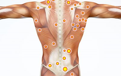 Everything You Need to Know About Trigger Point Therapy Massage